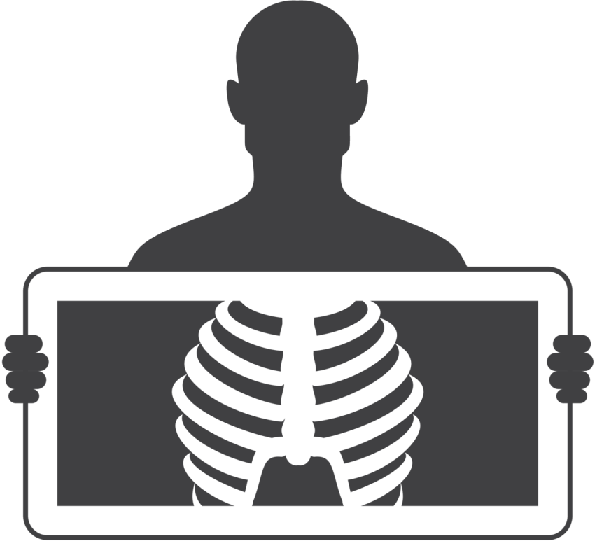 X Ray PNG Transparent Background Free Download