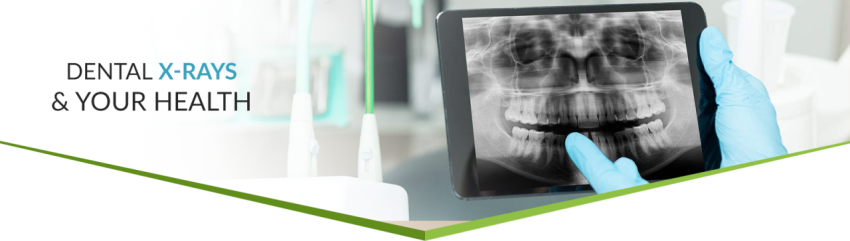 Isolated Free X Ray PNG Image Free Download