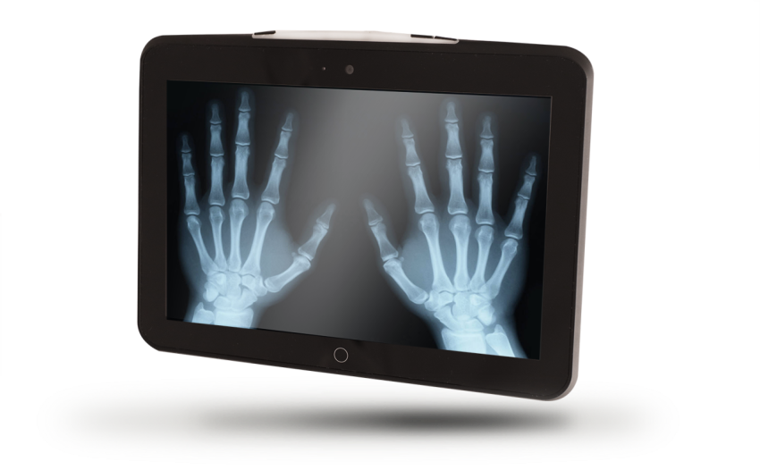 X Ray On Hands Image PNG  Screen Image