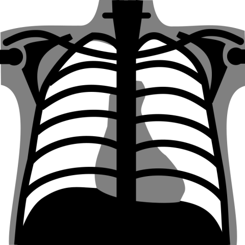 Lung X Ray PNG Image Free Download