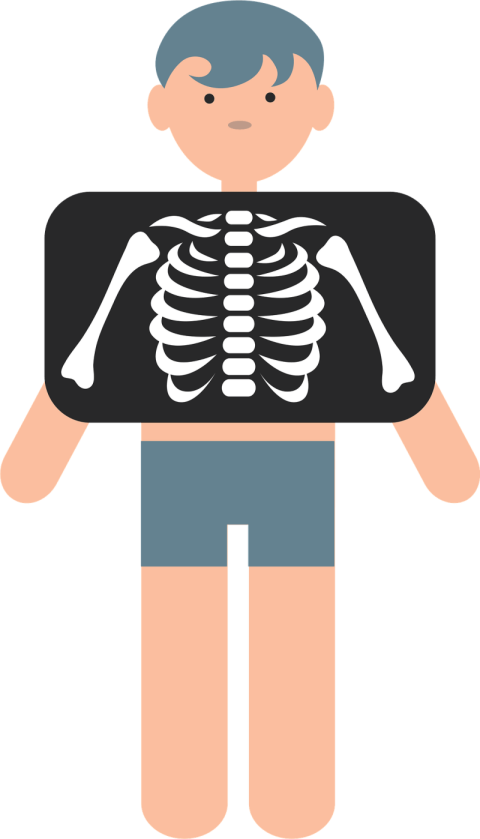 Little boy chest X Ray PNG Image free Sticker
