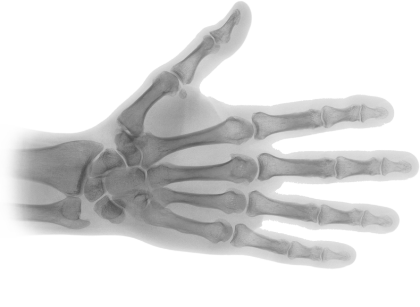 Transparent Hand X Ray PNG Image Free Download