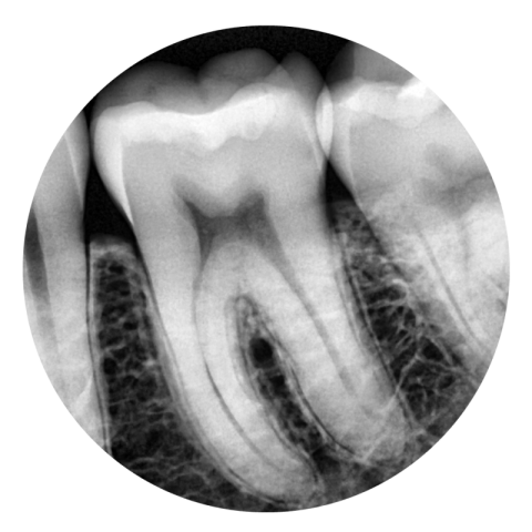 Circle teeth X Ray PNG Sticker Free Download