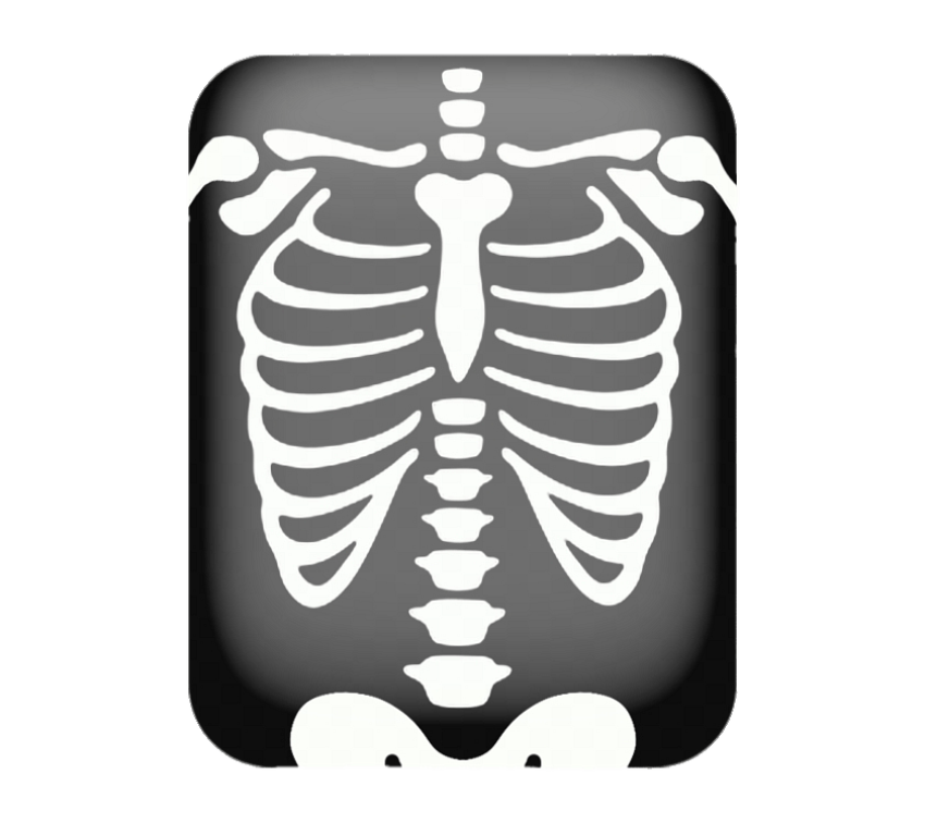 Half body X Ray PNG Image Free Download