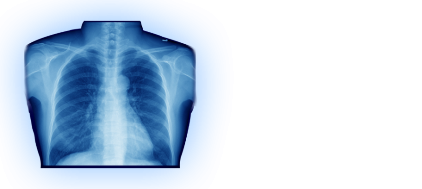 Radiology X Ray PNG Illustration Image