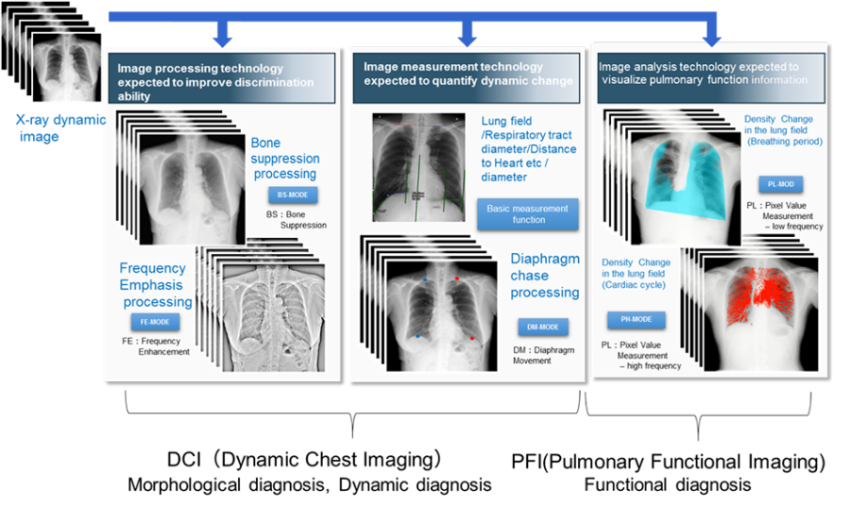 Electromagnetic Spectrum X Ray PNG Image