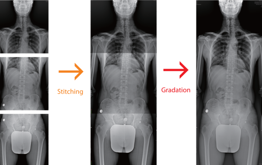 Human Body X Ray PNG Picture Free Download