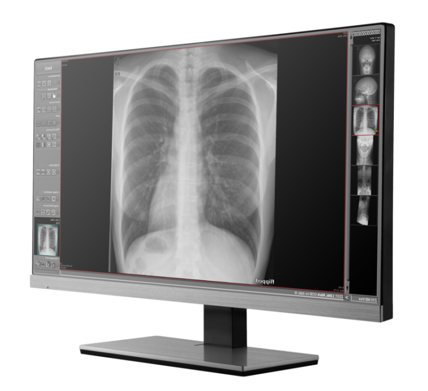 X Ray PNG LCD Free Transparent Image